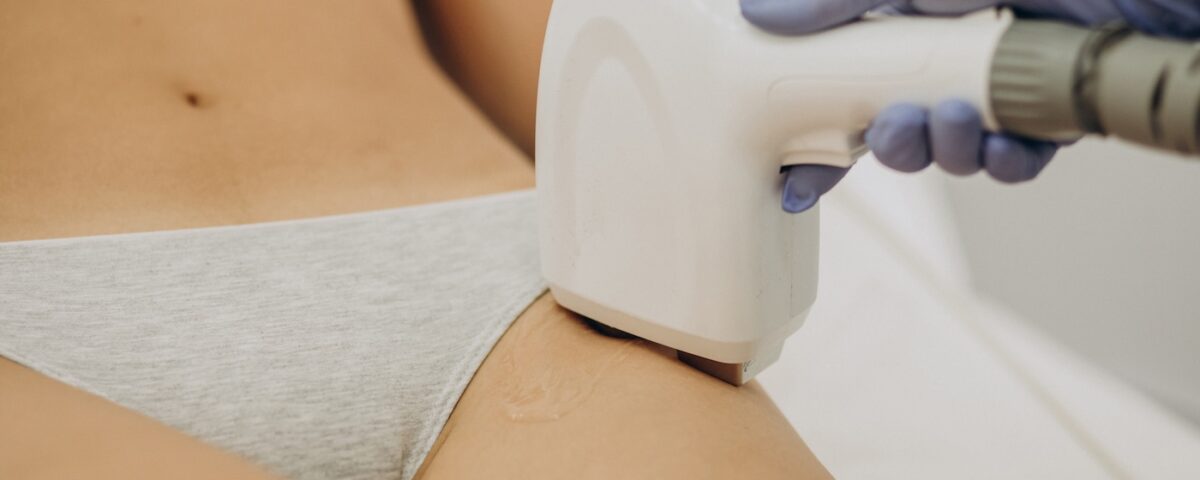 laser alessandrite epilazione medicale