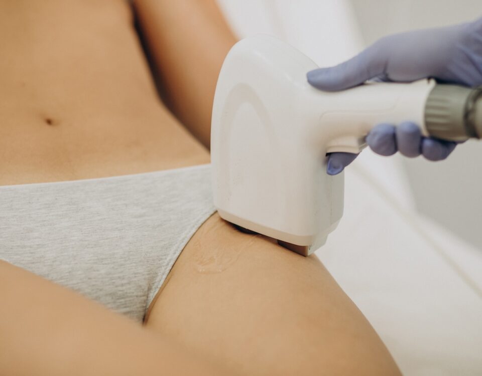laser alessandrite epilazione medicale