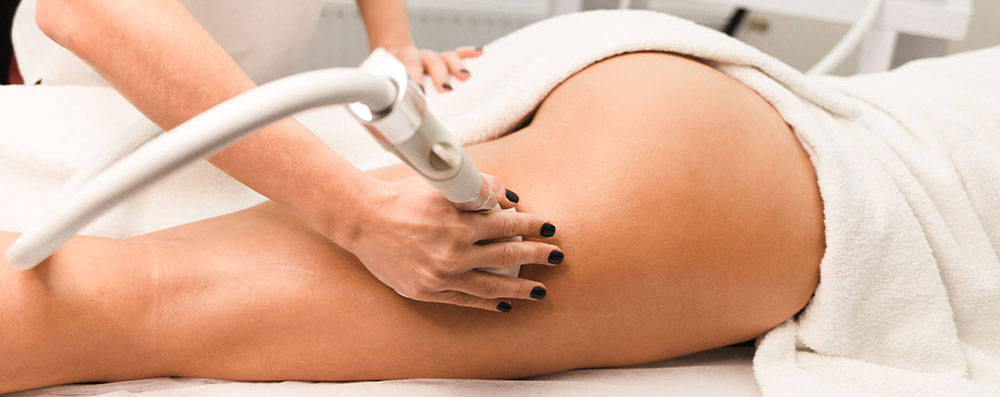 Trattamenti Cellulite